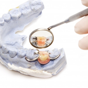 Dental Bridge